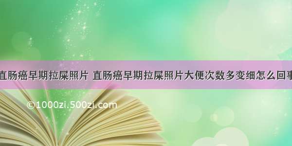 直肠癌早期拉屎照片 直肠癌早期拉屎照片大便次数多变细怎么回事