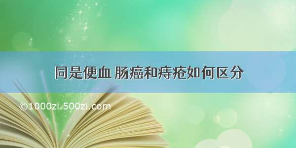 同是便血 肠癌和痔疮如何区分