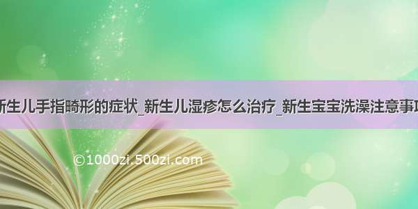 新生儿手指畸形的症状_新生儿湿疹怎么治疗_新生宝宝洗澡注意事项