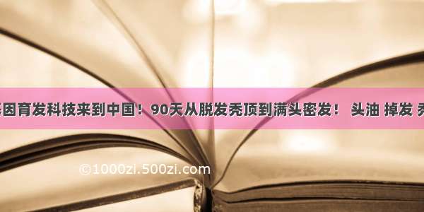 新一代基因育发科技来到中国！90天从脱发秃顶到满头密发！ 头油 掉发 秃顶 斑秃 