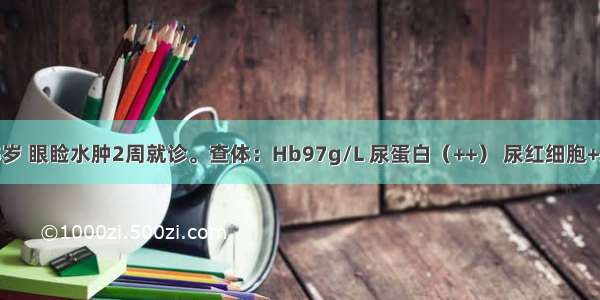 患儿 男 5岁 眼睑水肿2周就诊。查体：Hb97g/L 尿蛋白（++） 尿红细胞+/HP 尿比